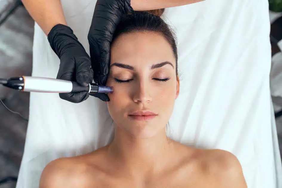 SkinPen Microneedling in Vancouver, WA by Venus Rising Med Spa LLC