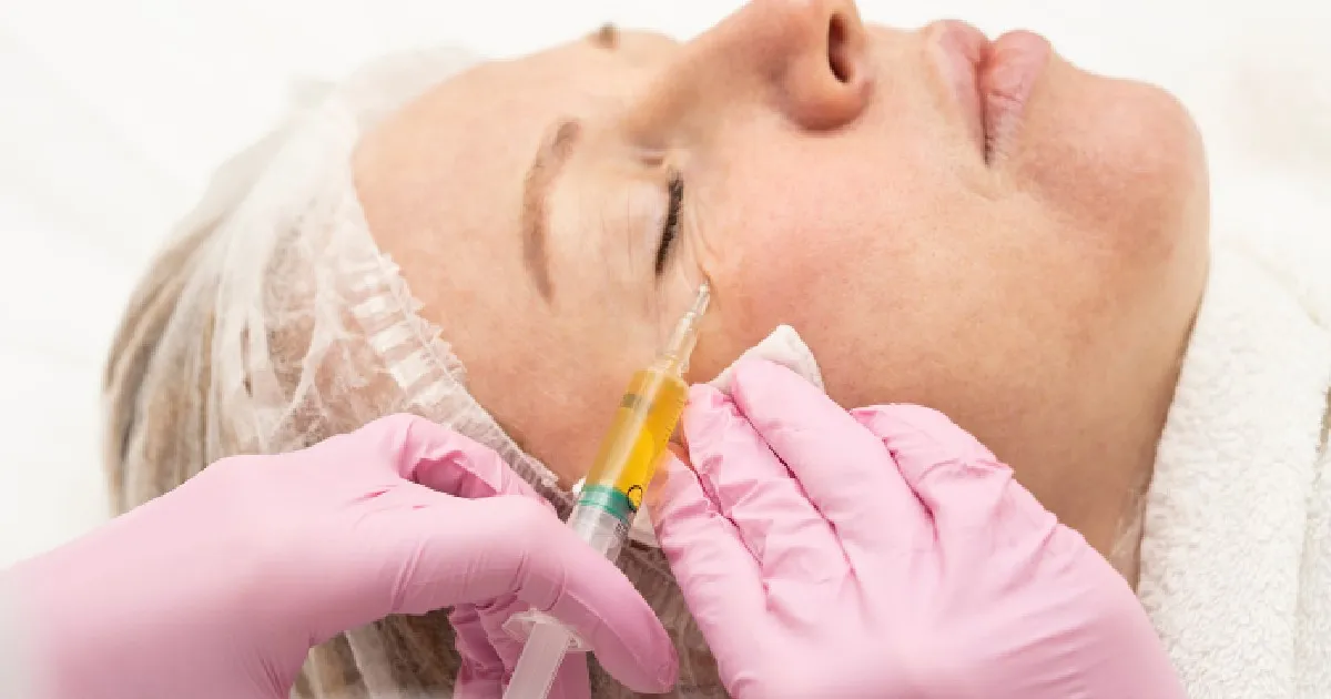 Old Women taking PRF for Under Eye Rejuvenation in Vancouver, WA